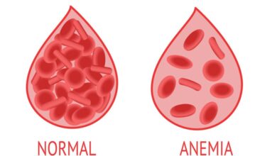 30% Remaja Putri Cirebon Alami Anemia, Temukan Pemicunya!